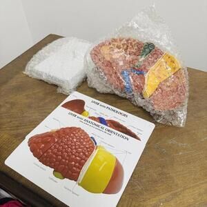 GPI Anatomicals Diseased Liver Anatomy Model 3310 – Student Medical Teaching Aid
